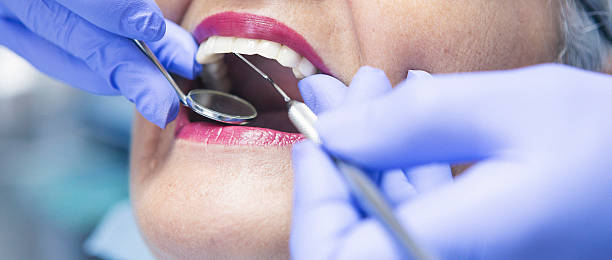 Best Broken or Cracked Tooth Emergency Dentist in Sa De Oro Mount Helix, CA