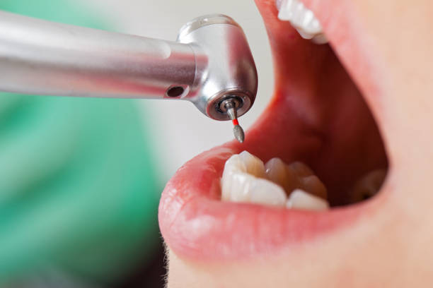 Best Pediatric Emergency Dentist in Sa De Oro Mount Helix, CA